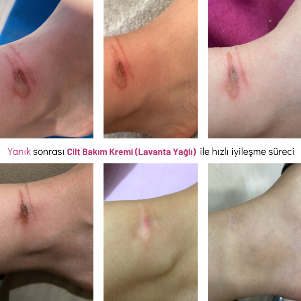 Cilt Bakım Kremi (Lavanta Yağlı)