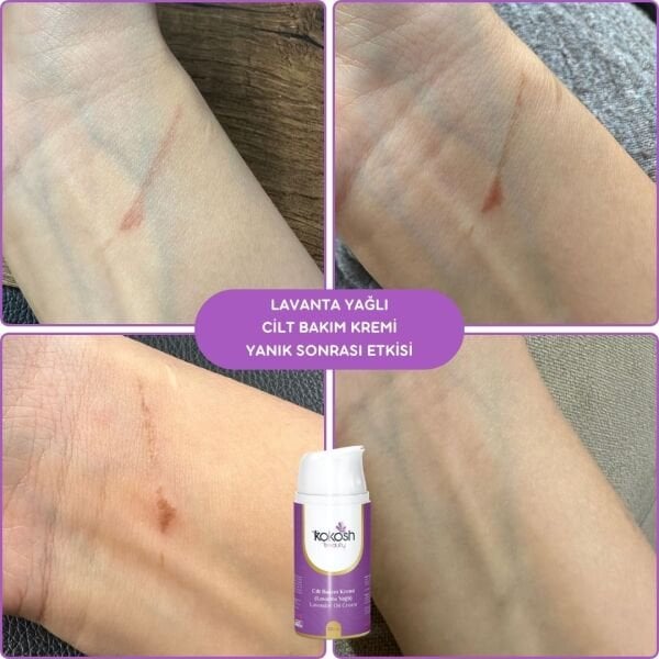 Cilt Bakım Kremi (Lavanta Yağlı)