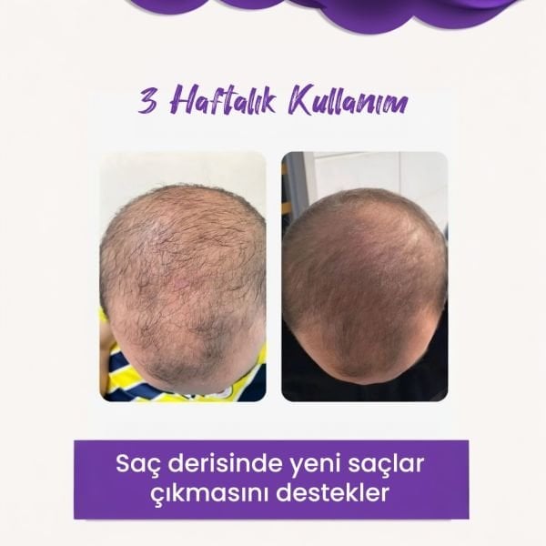 Biotin & Kafein Besleyici Saç Serumu