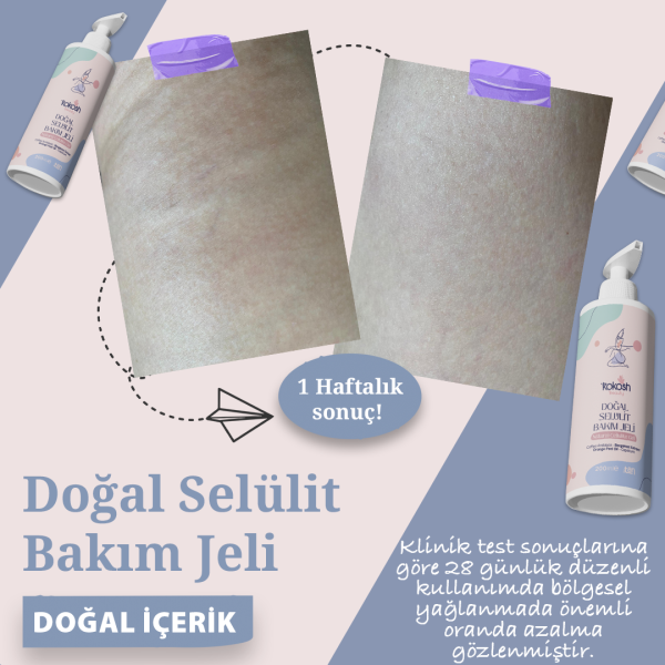 Doğal Selülit ve Çatlak Bakım Jeli